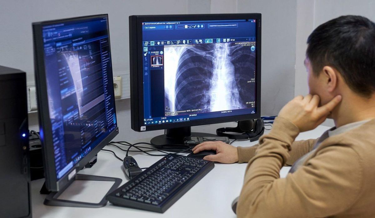 В московских поликлиниках внедрят расшифровку рентген-исследований через ИИ